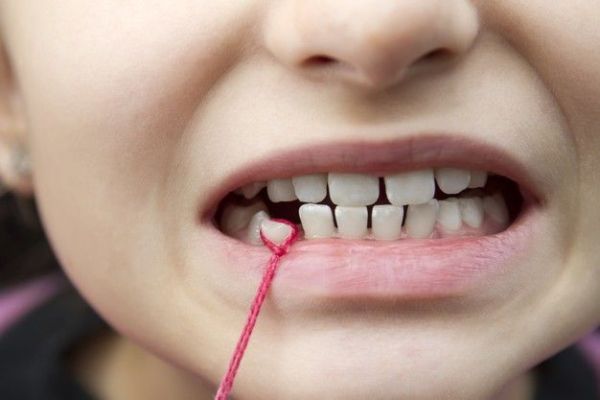 Rituels indispensables pour préserver les dents de lait