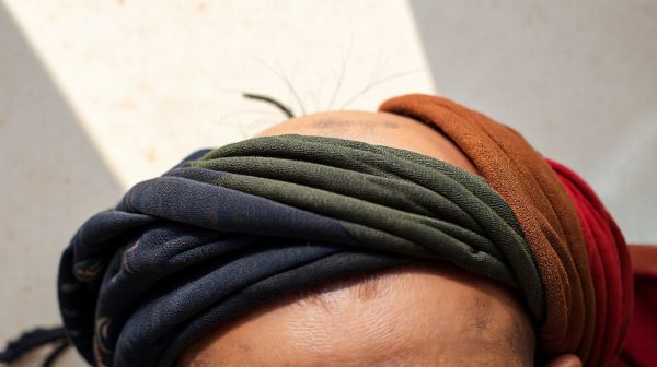 Top 5 turbans chimiques pour un confort optimal du cuir chevelu